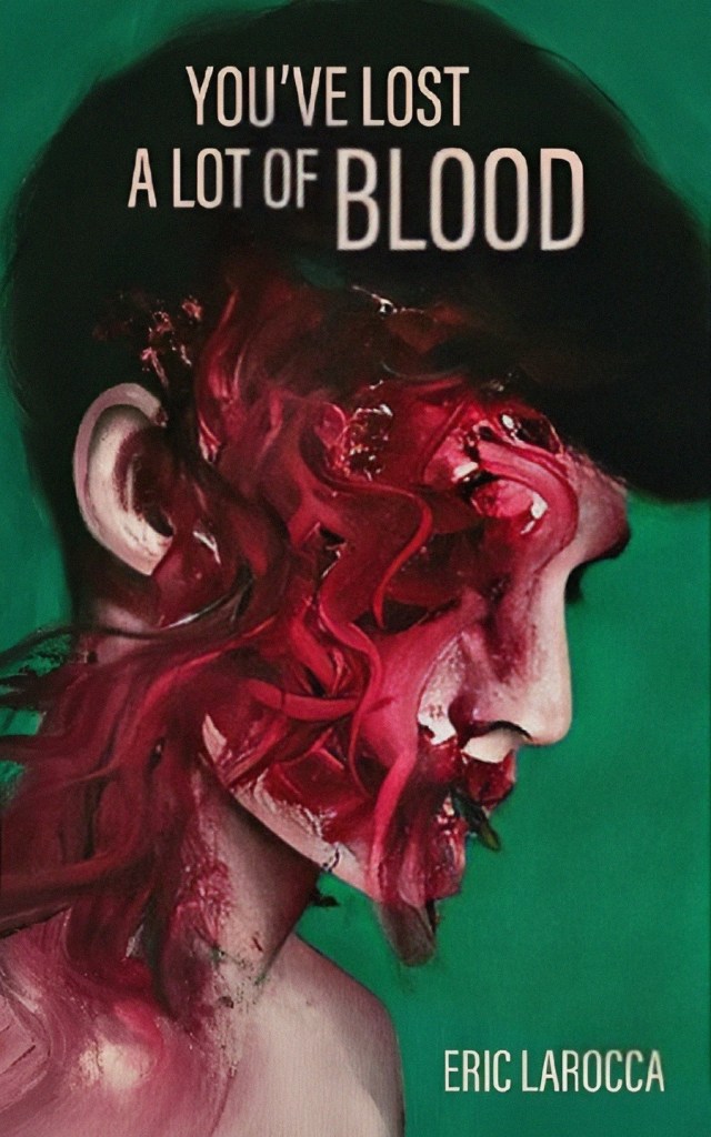 you've lost a lot of blood
